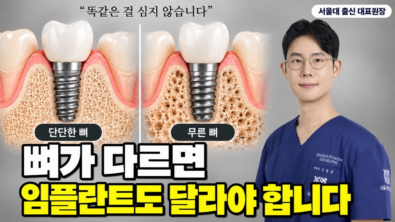 임플란트 브랜드, 뭘 심어야 할까요 상담 전에 꼭 확인할 3가지