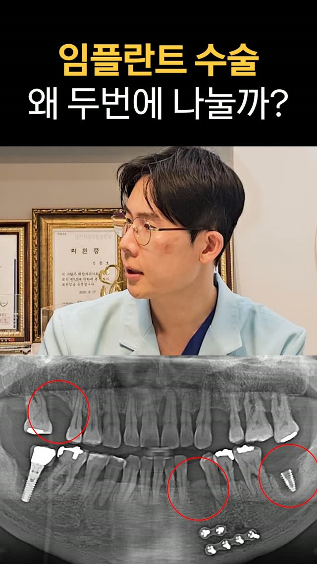 임플란트 수술, 왜 두 번에 나눌까요?