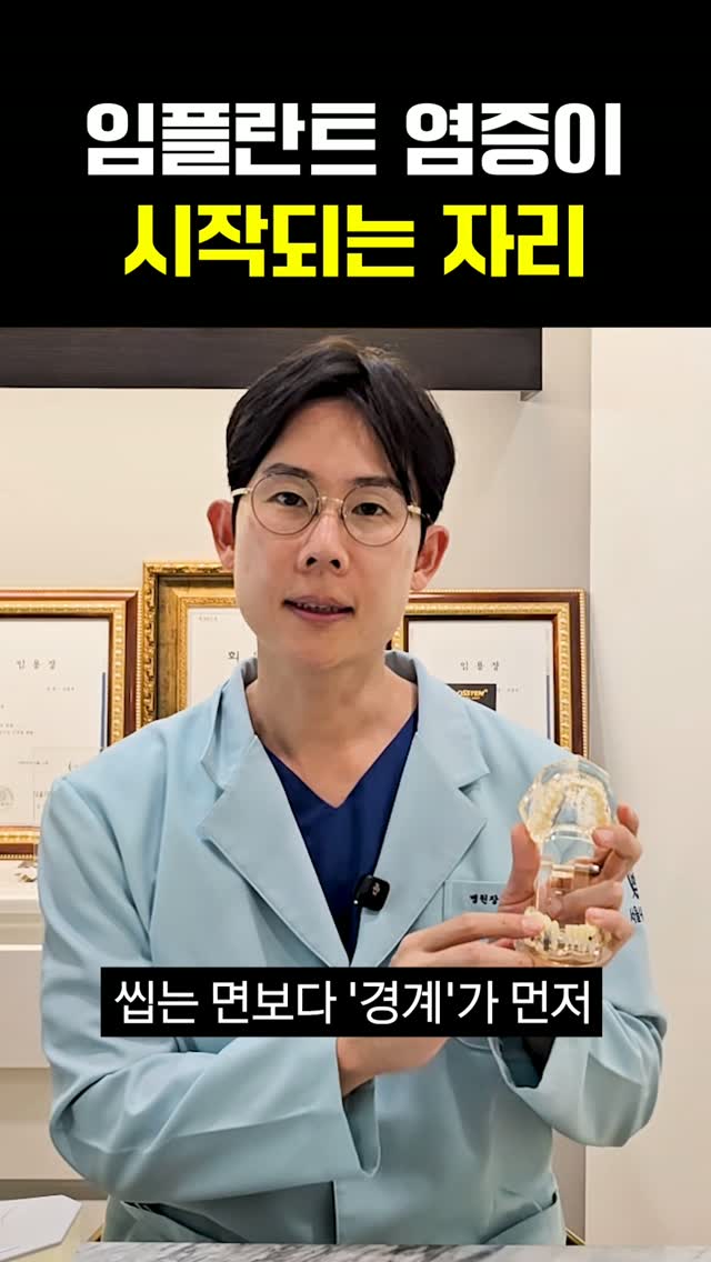 임플란트, 씹는 면만 닦으면 놓치는 곳