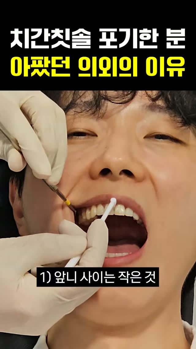 치간칫솔 한 가지 사이즈만 사용하시나요?