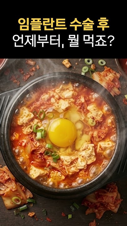 임플란트 수술 후, 언제부터 뭘 먹을 수 있을까요