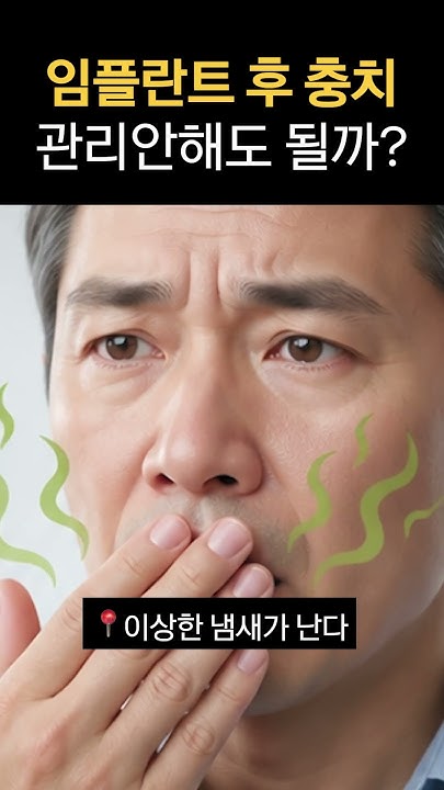 임플란트는 충치가 안 생기니까, 관리 안 해도 될까요